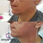центр косметологии promo italia  - tattooo.ru